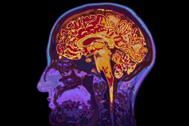 How Is Your Brain Actually Doing? You May Be Surprised by What This Easy Scorecard Can Tell You