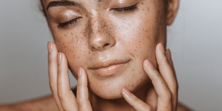 Having a hard time with hyperpigmentation? This Is Why Your Skincare Routine Should Include Tranexamic Acid
