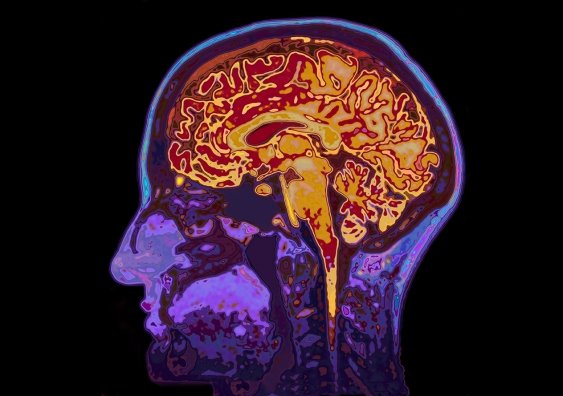 How Is Your Brain Actually Doing? You May Be Surprised by What This Easy Scorecard Can Tell You