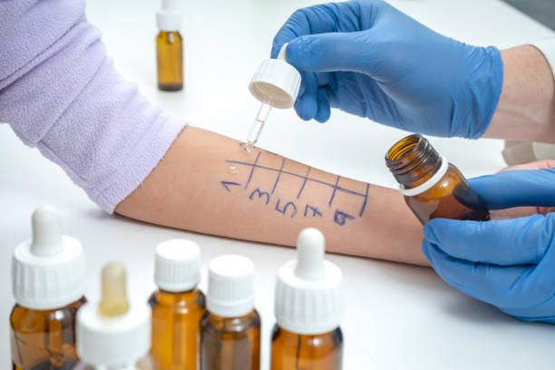 Is It Possible to Treat Dust Mite Allergies with a Pill?