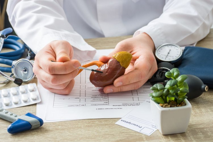 The Complete Guide to Treatment Options for Kidney Stones.
