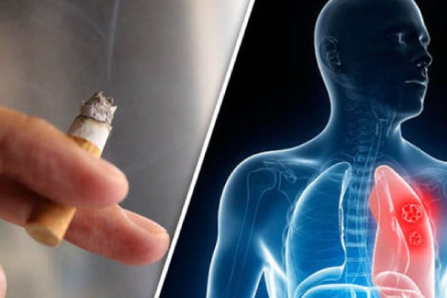Smoking and Prostate Cancer: Why Lighting Up Could Make the Disease Deadlier