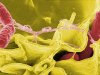 How Salmonella Works and What You Can Do About It Salmonella is a Cunning Little Germ.