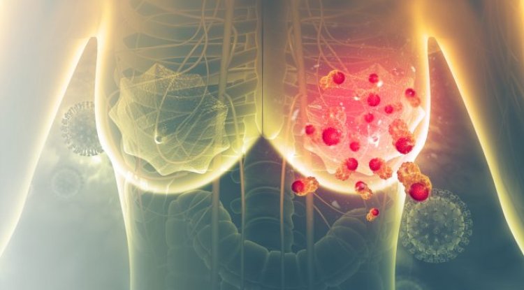 A Novel Approach to Treating Early-Stage Breast Cancer: How Targeted BRCA Therapy Is Revolutionizing the Field